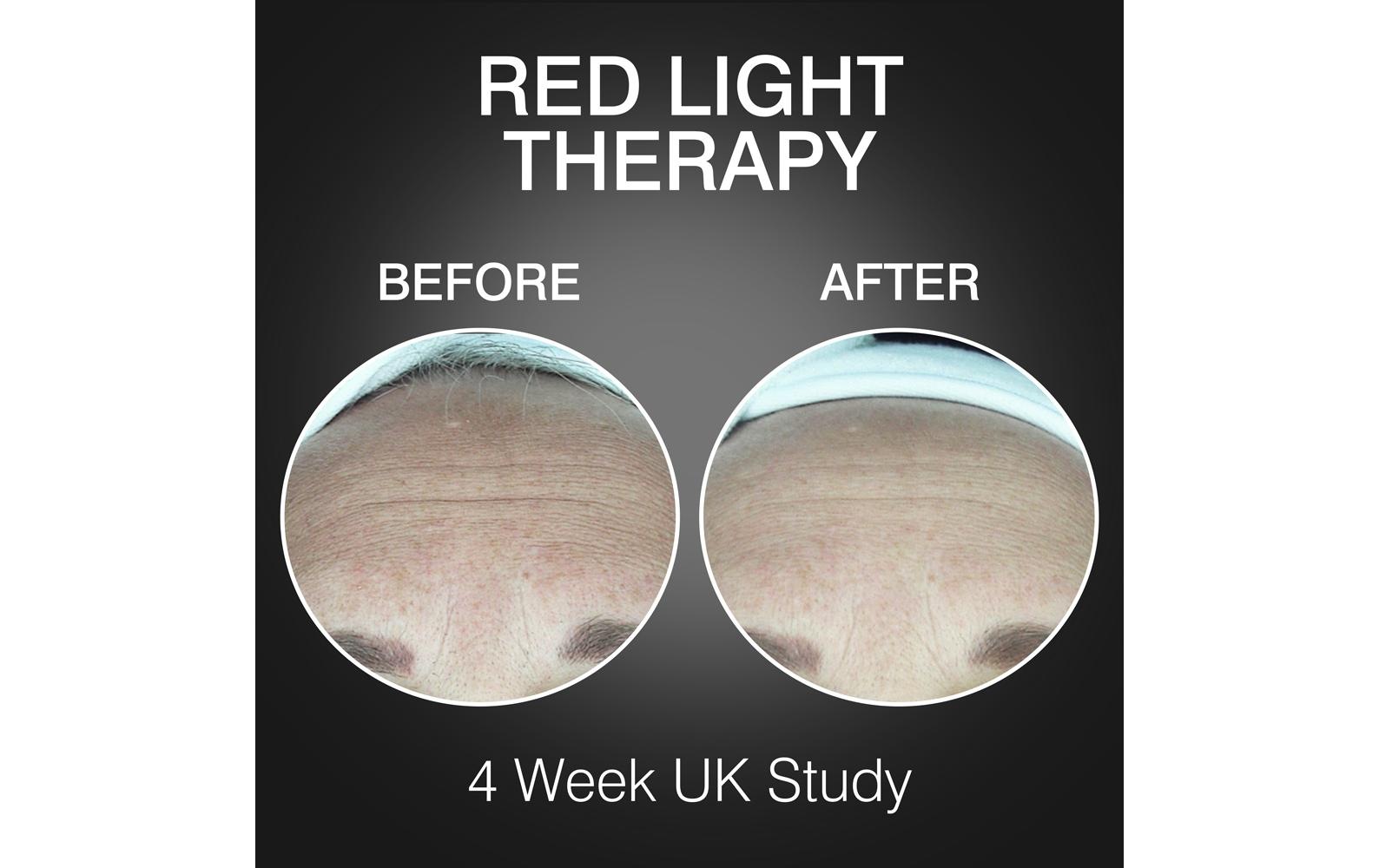 Rio Lichttherapiegerät »FaceGLO 1072 mit Serum«