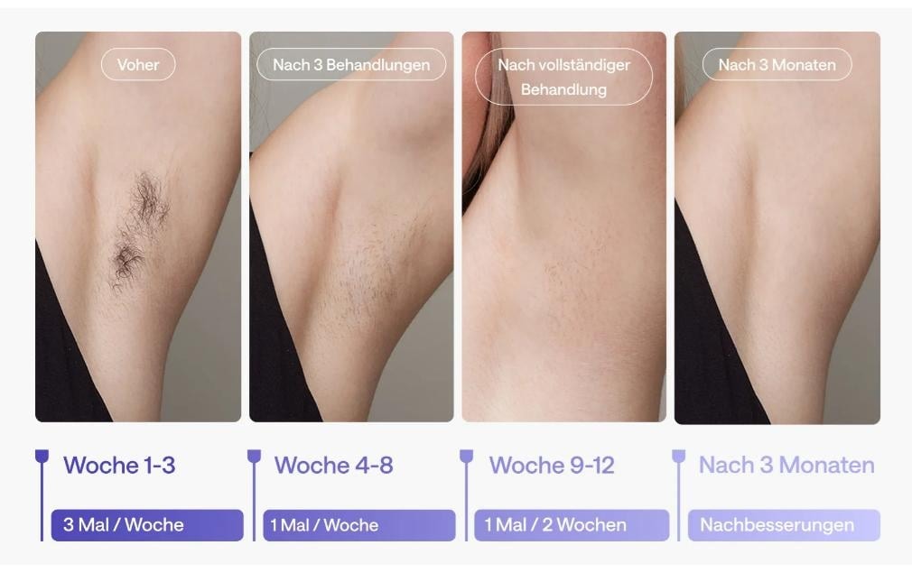   Épilateur IPL »Ulike Air 3«