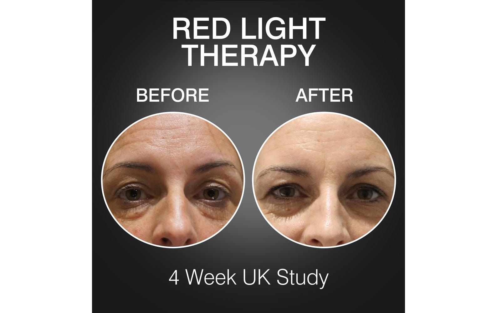 Rio Lichttherapiegerät »FaceGLO 1072 mit Serum«