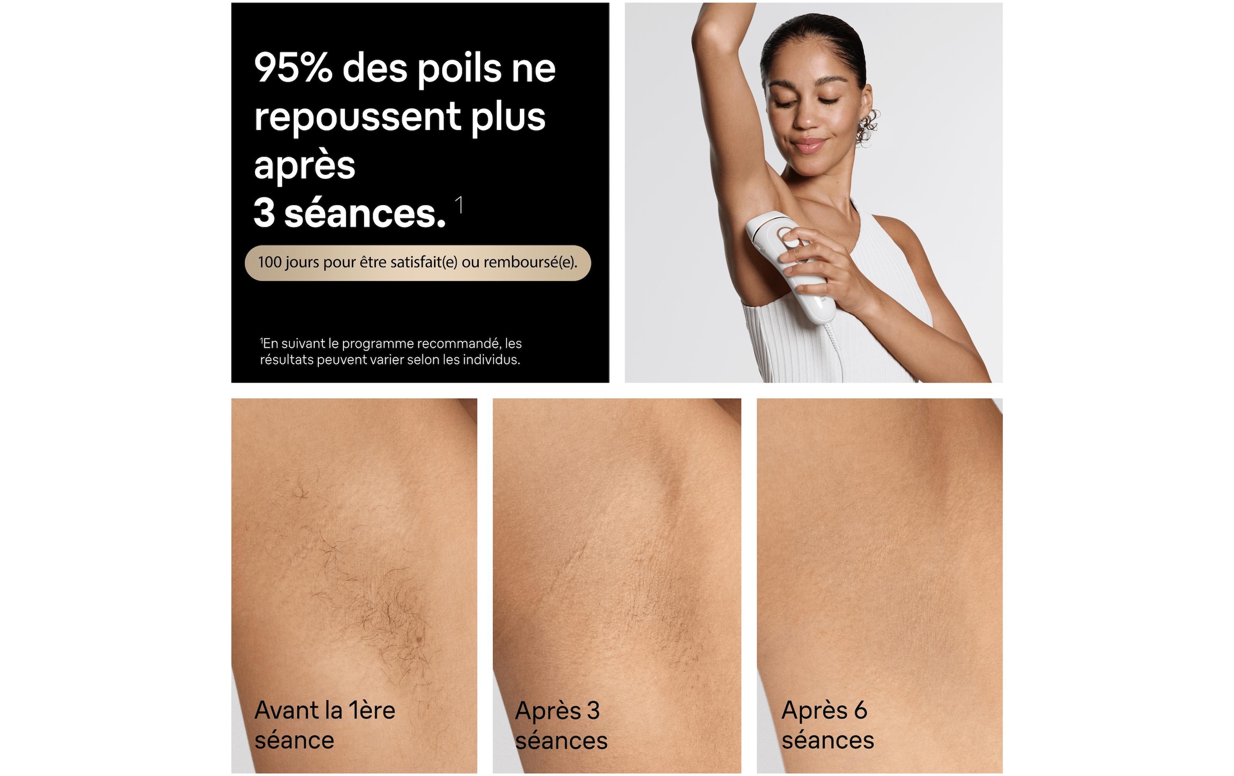 Braun Épilateur IPL »Silk-expert Pro IPL PL5431« 400.000 Lichtimpulse dauerhafte Haarreduktion, mit Tasche, Venus Rasierer, 4 Aufsätze