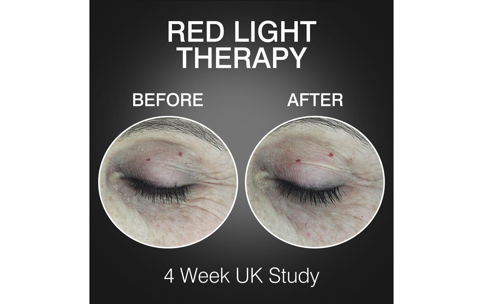 Rio Lichttherapiegerät »FaceGLO 1072 mit Serum«