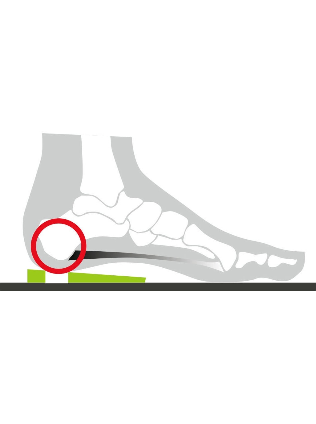   Fersenkissen »Fersenspornkissen«