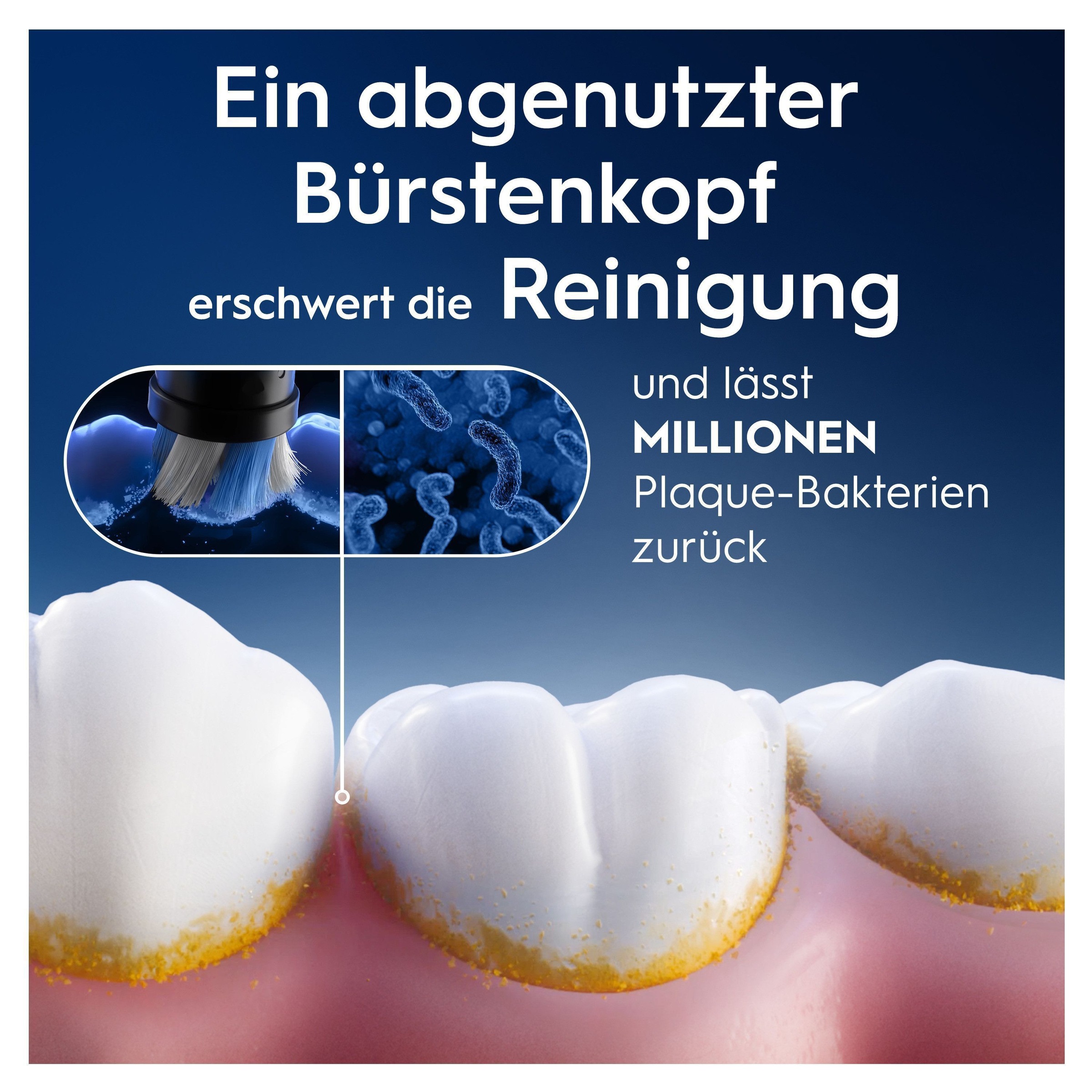 Oral-B Aufsteckbürsten »Oral-B iO Strahlendes Weiss« fortschrittliche Plaque-Entfernung, Poliereinsätze zur Zahnaufhellung