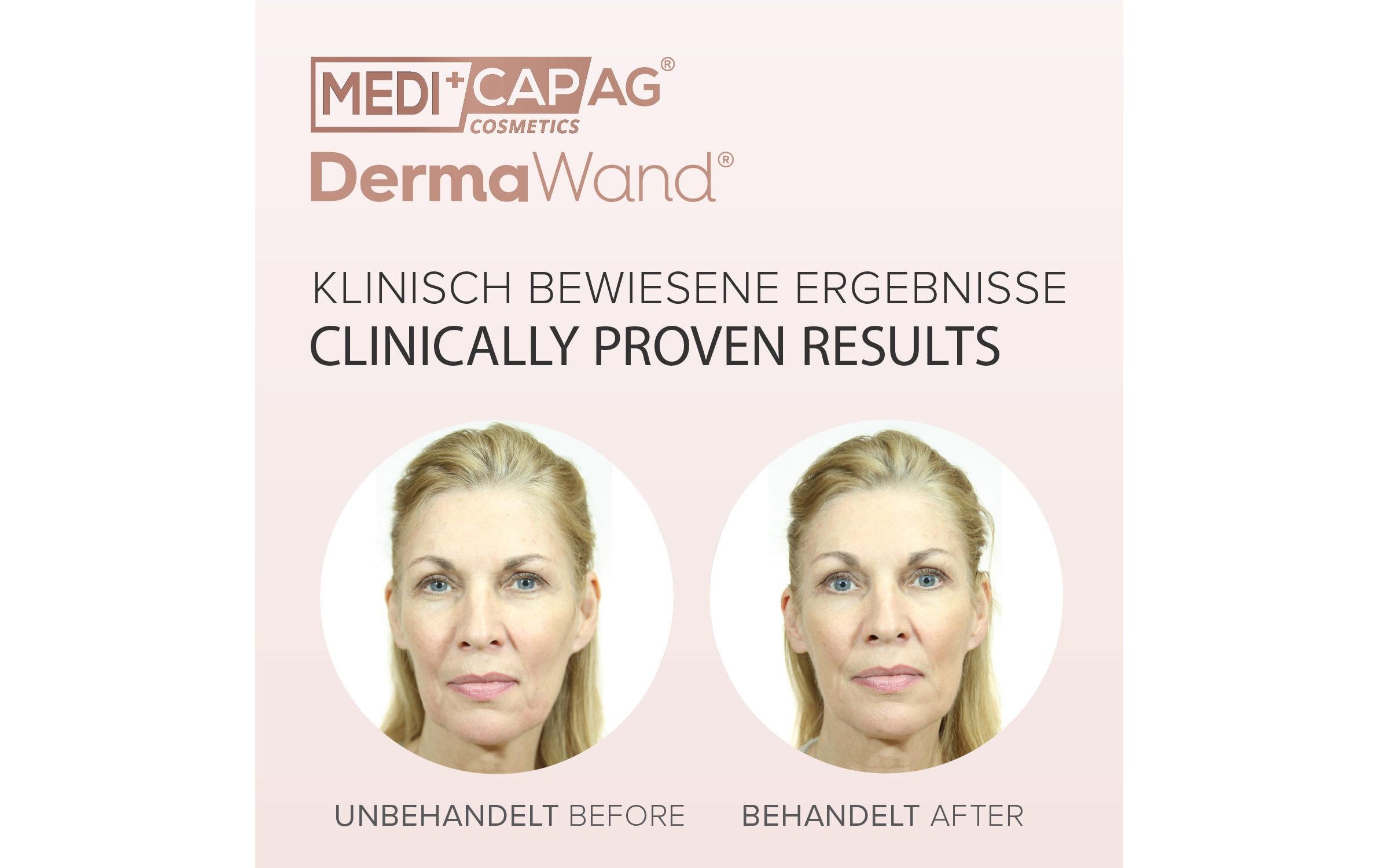 Anti-Aging-Gerät