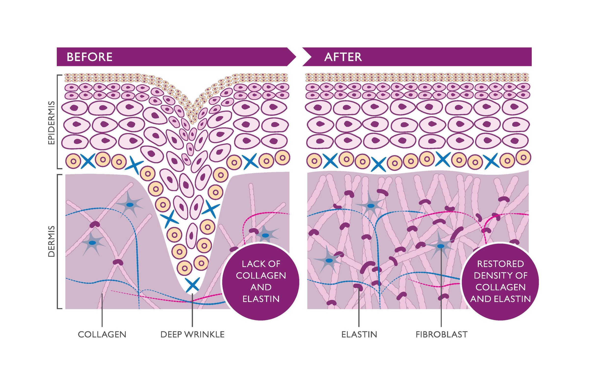 Silk'n Anti-Aging-Gerät »Antiaging-Gerät FaceTite Ritual«