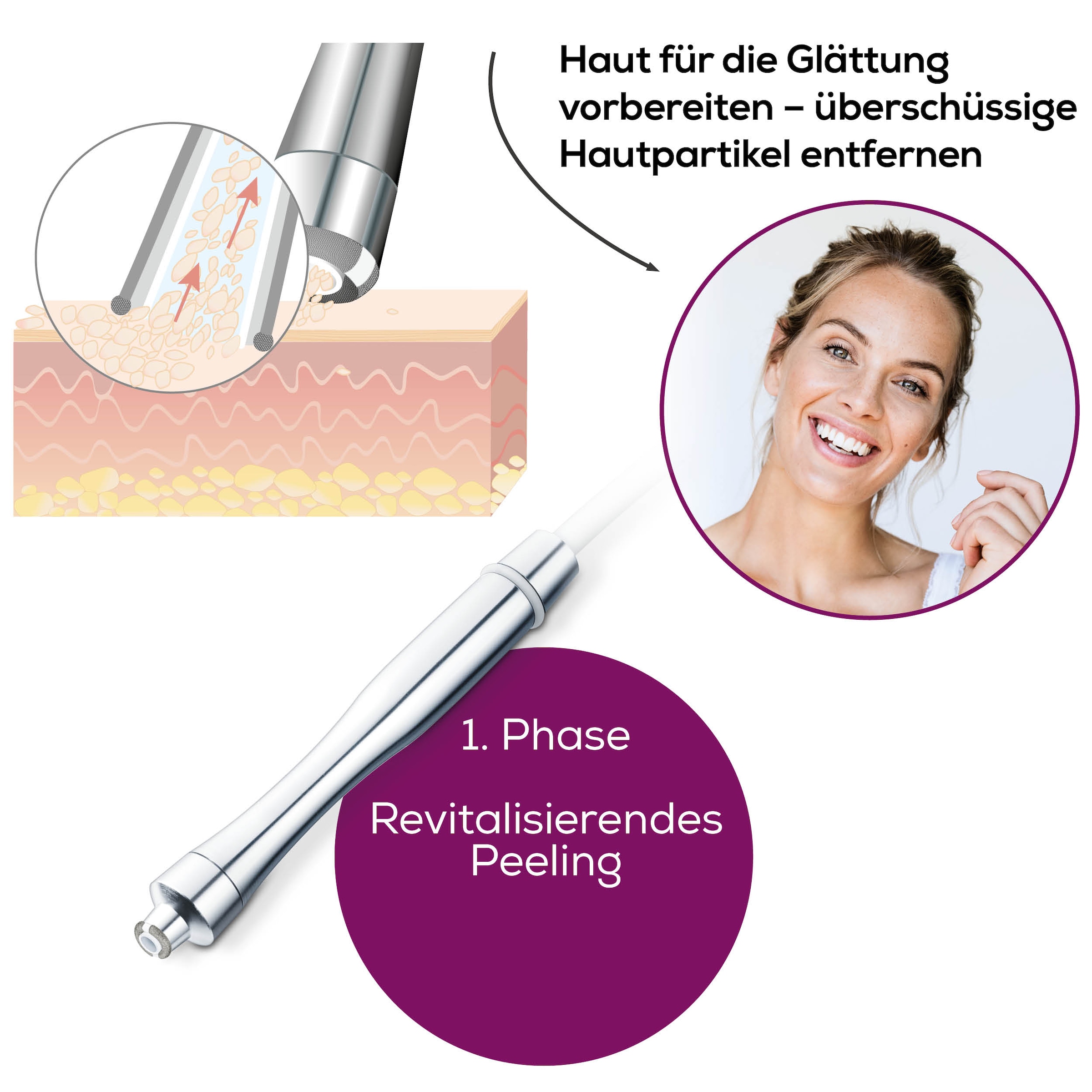 BEURER Mikrodermabrasionsgerät »FC 100 Mikrodermabrasionsgerät für ein revitalisierendes Peeling«, Mit 5 Intensitätsstufen und 3 hochwertigen Aufsätzen