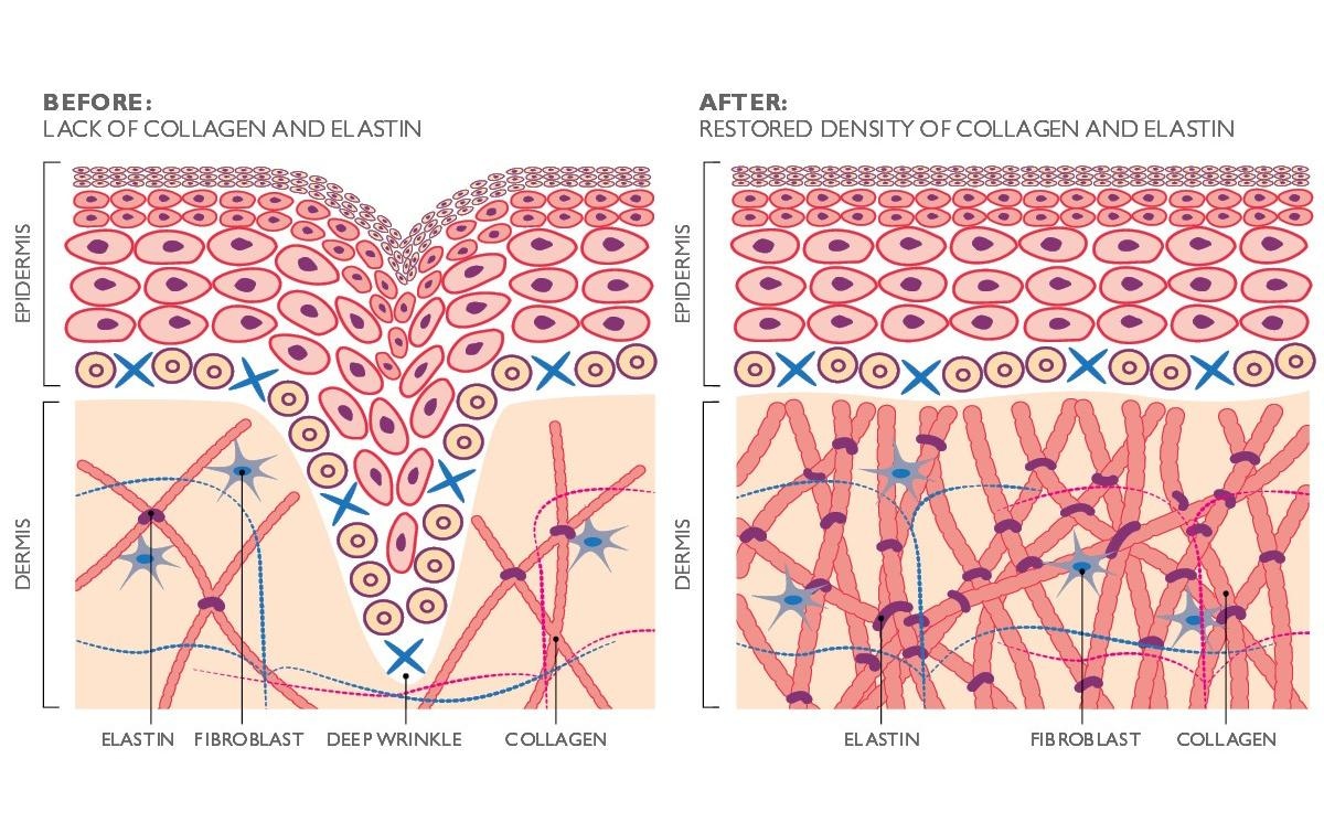 Silk'n Anti-Aging-Gerät »FaceTite Revive Cordless Weiss«