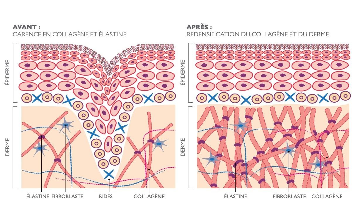 Silk'n Anti-Aging-Gerät »FaceTite Revive Cordless Weiss«