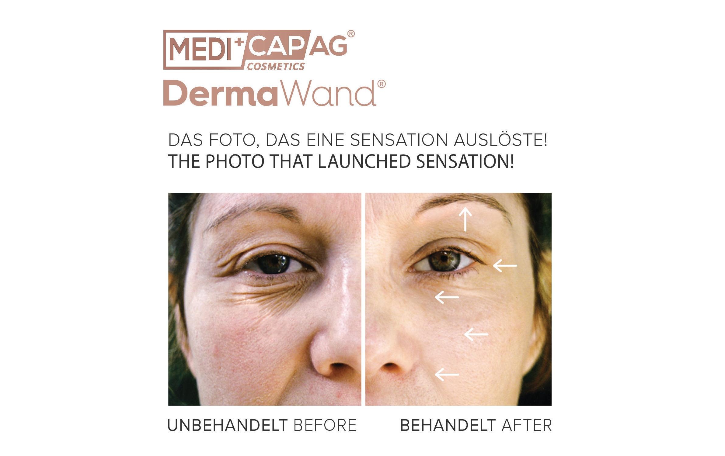 Anti-Aging-Gerät